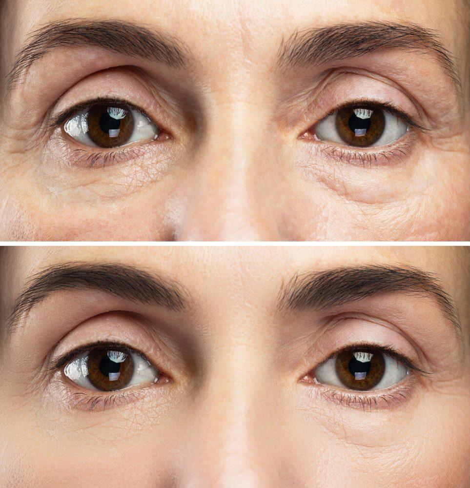 Facial Treatments 18 15494