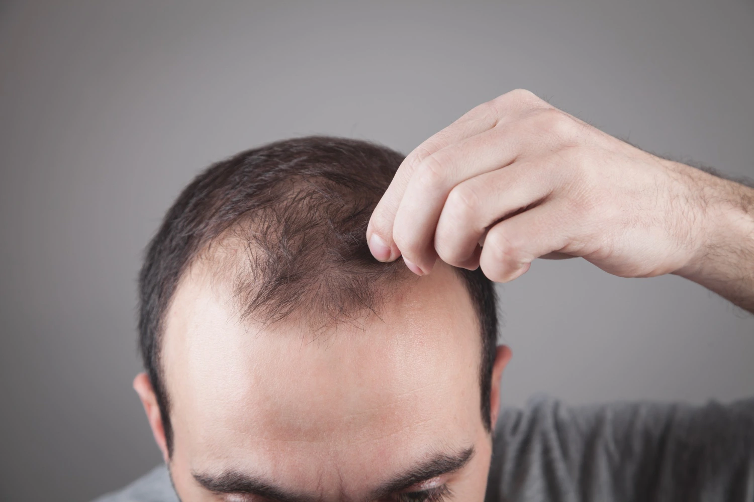 Hair Loss Treatment