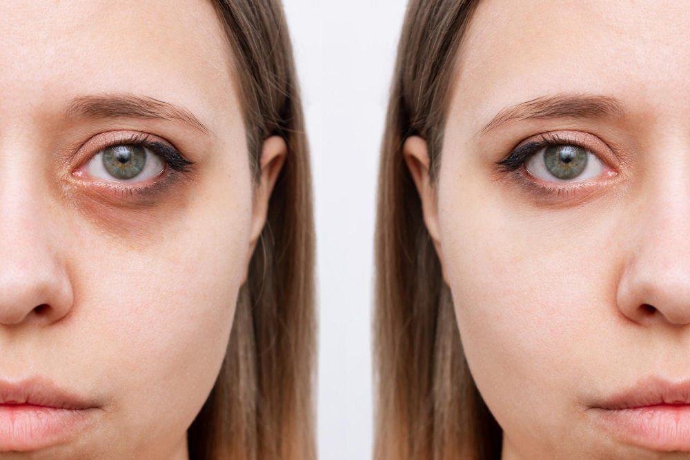 Facial Treatments 20 1643
