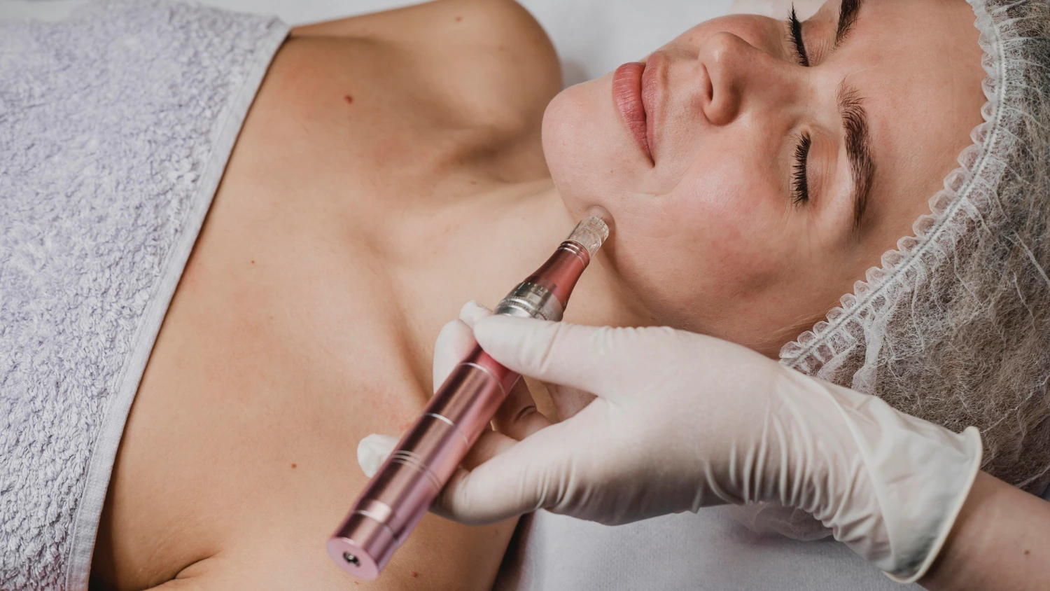 Skin Rejuvenation / Vampire Face with PRP/PRF 2 2148825321