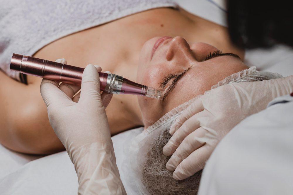 Dark eye circles / under eye rejuvenation with PRP/PRF 2 2148825322