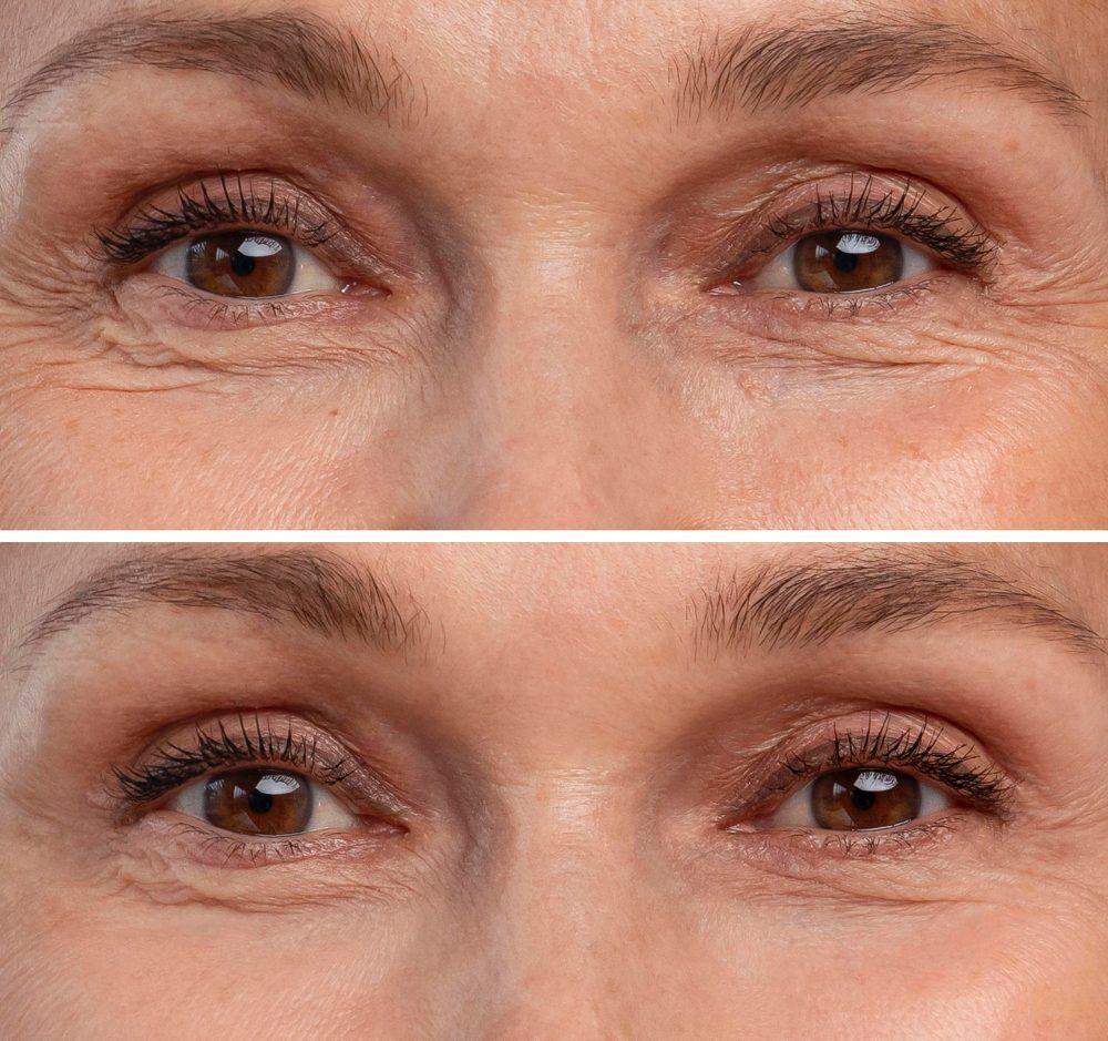 Facial Treatments 19 2149123606