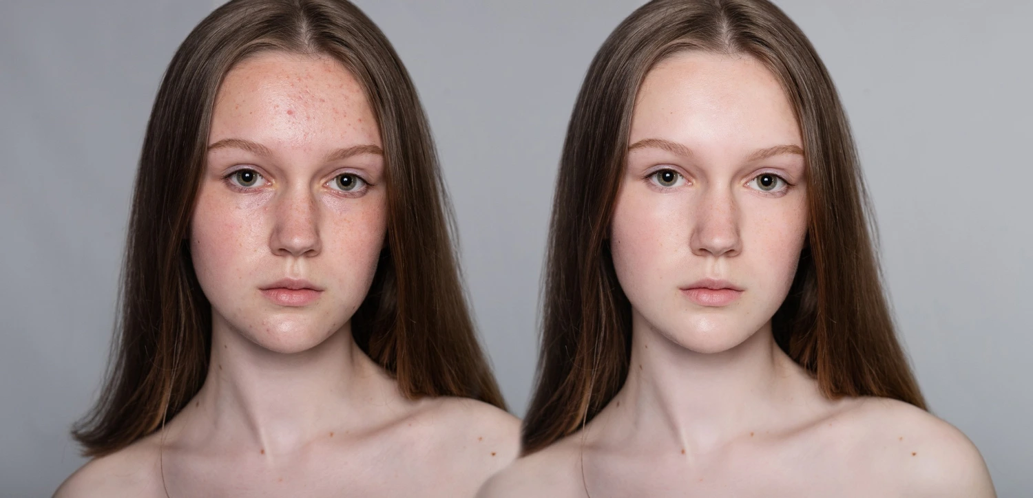 Facial Treatments 16 5377