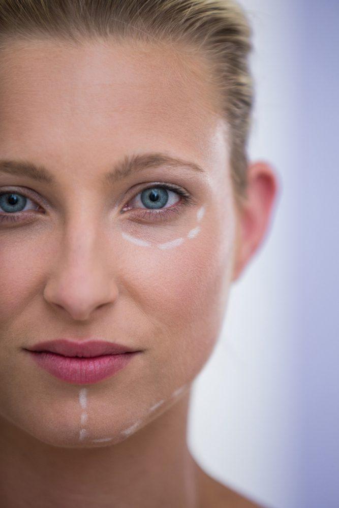 Dark eye circles / under eye rejuvenation with PRP/PRF 1 74110
