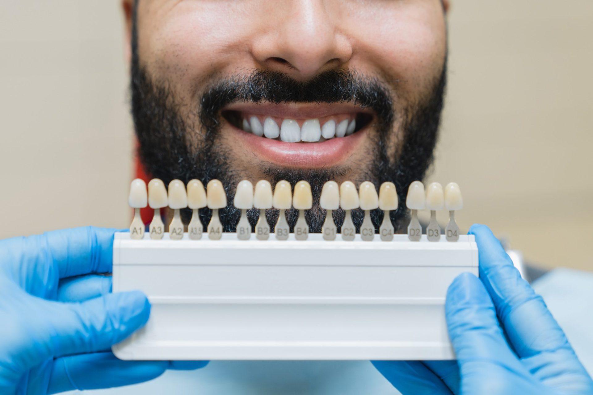 dental care implants for veneers man with perfect smile choosing teeth tooth tone at dental clinic dental care implants for veneers man with perfect smile choosing teeth tooth tone at dental clinic