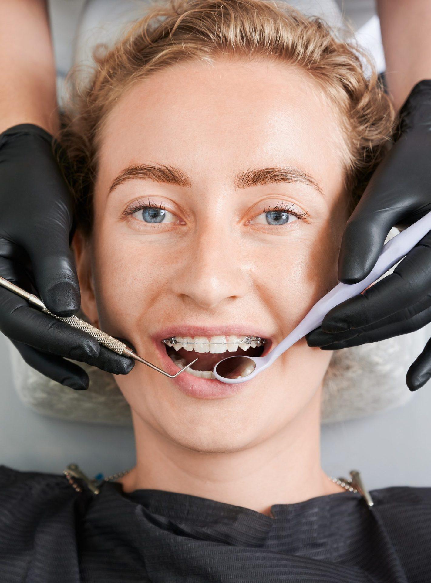 Ceramic Braces 26 dentist examining woman teeth with braces