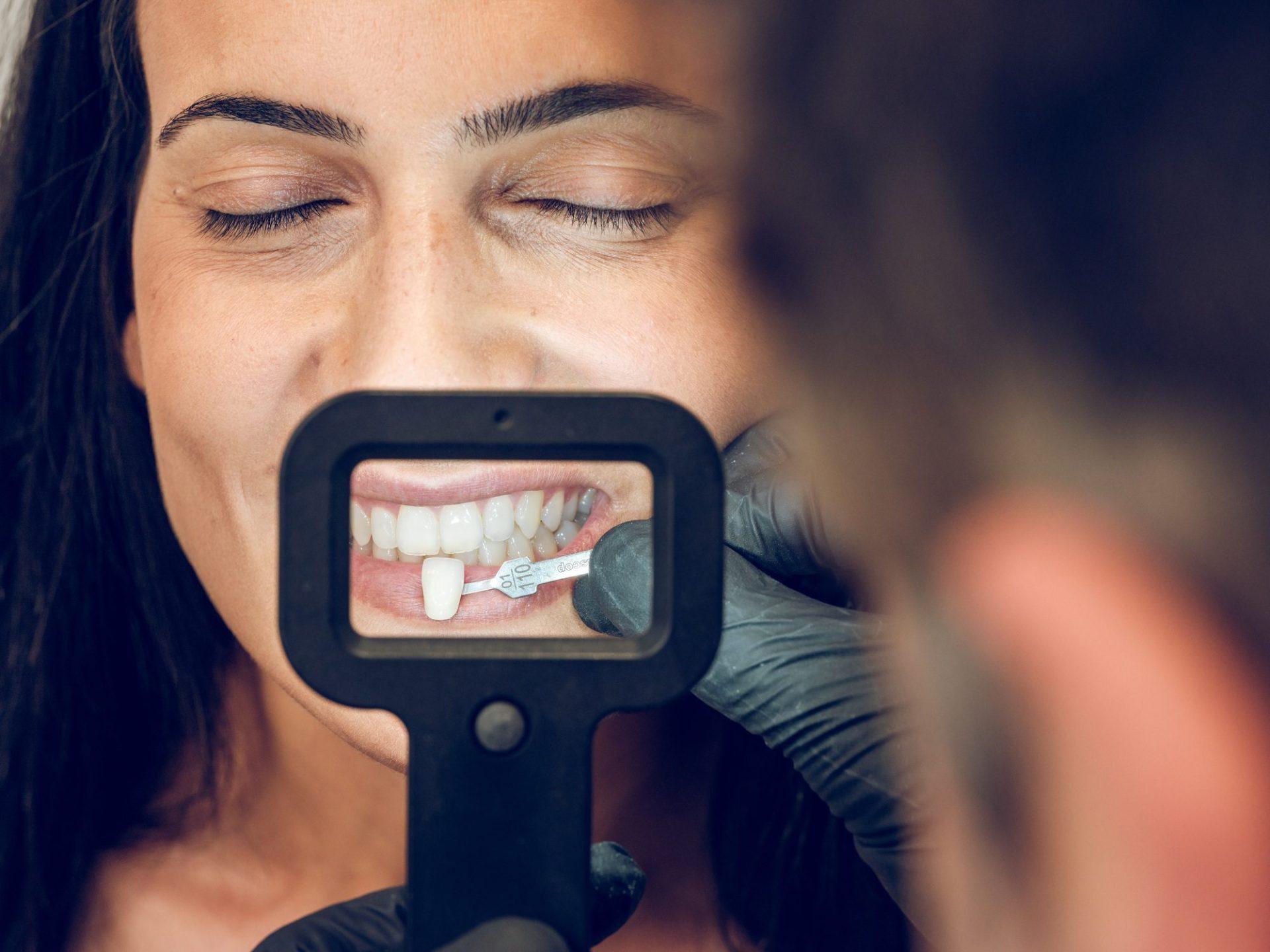 dentist picking sample of teeth veneer for woman dentist picking sample of teeth veneer for woman