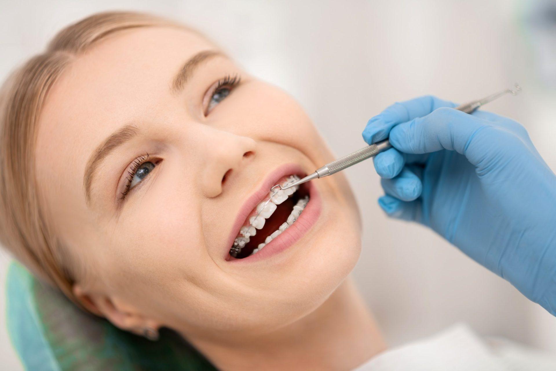 Ceramic Braces 28 patient fixing her orthodontic braces in dental clinic