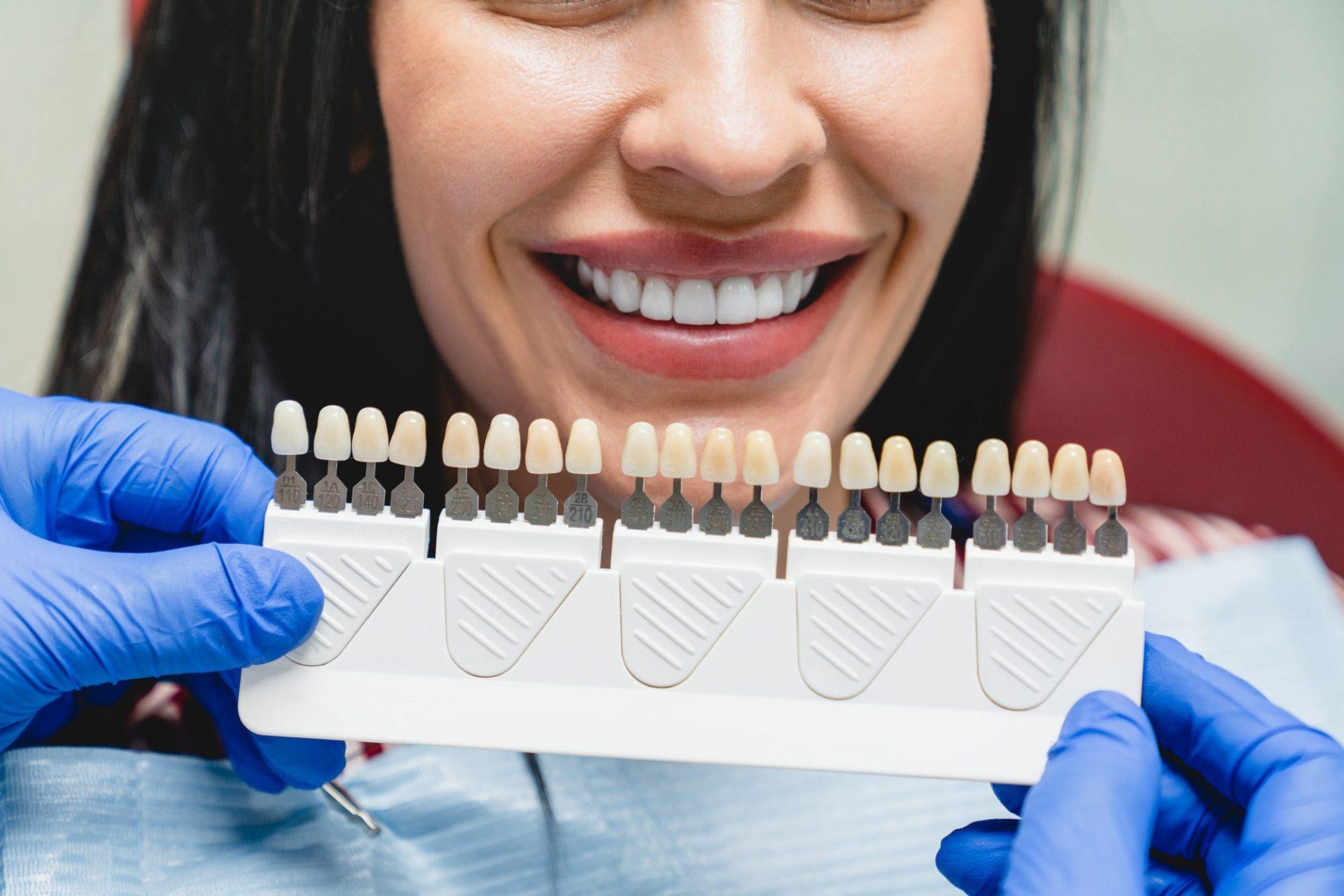 whitening concept dental care implants veneers woman with perfect smile choosing teeth tooth tone whitening concept dental care implants veneers woman with perfect smile choosing teeth tooth tone