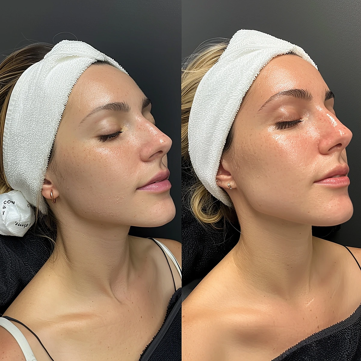 Facial Treatments 17 woman with white headband her head 1