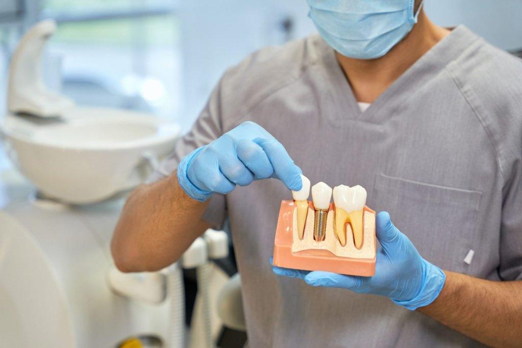 Restore Your Smile with Dental Implants Near Me West Ryde 5 skillful dental technician showing anatomy of dental implant