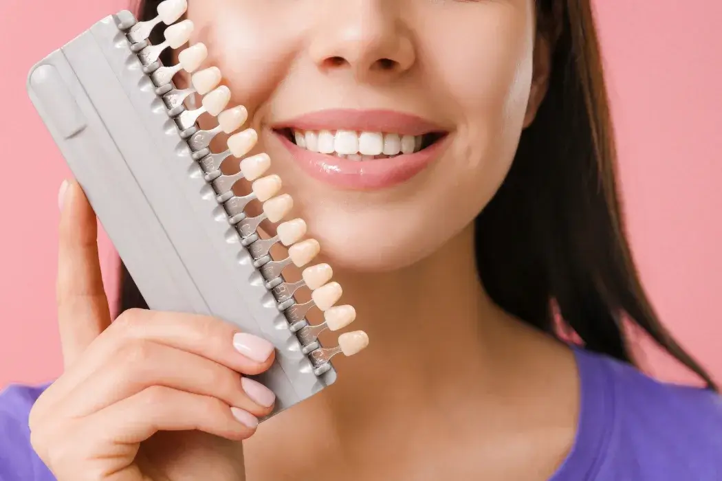 Composite Veneers 29 19
