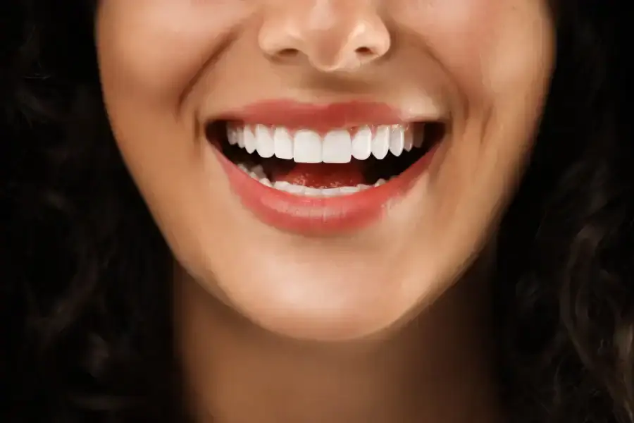 Full Mouth Implants