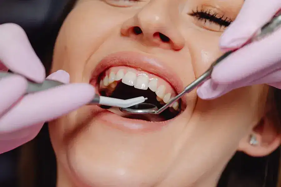 Step-by-Step Process for Getting a Single Tooth Implant