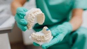 Dental Implant