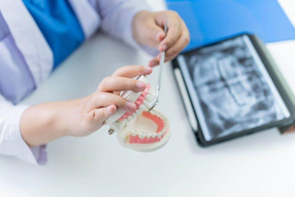 Can Dental Implants Restore Natural Chewing Function and Comfort? 17 Can Dental Implants Restore Natural Chewing Function and Comfort