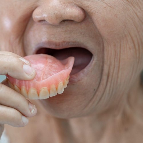 Dentures 13 Dentures