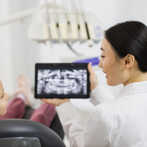Root Canal Treatment