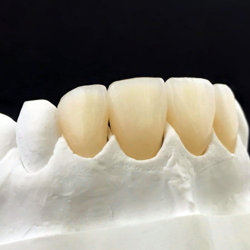 Crown And Bridge 15 dental zirconia crowns in the plaster model white dental veneer r8e7ogoa4hy48gasjf25bgea3z0p34l2w2o3ts8k94