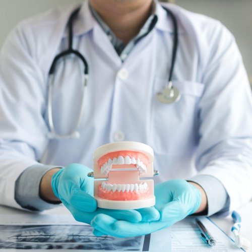 Dentures 14 dentures