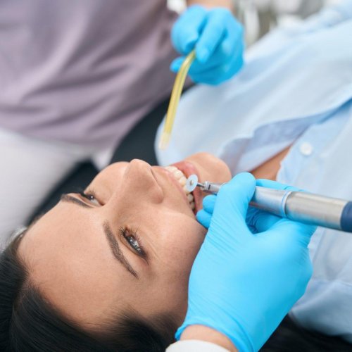 Dental fillings 14 dental fillings