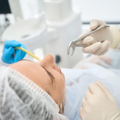 Teeth Extractions 16 Teeth Extractions