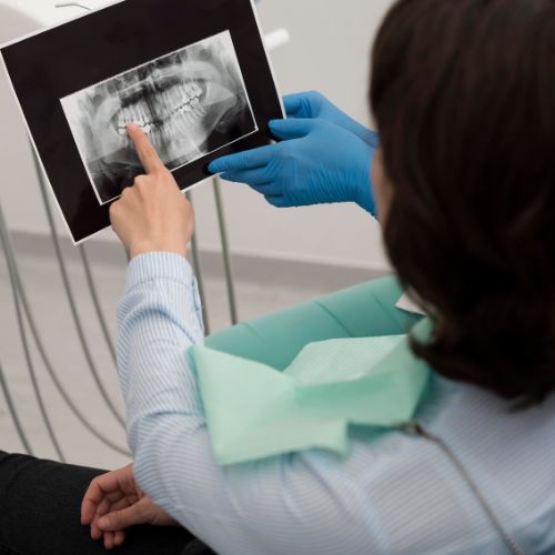 Intraoral Scanners