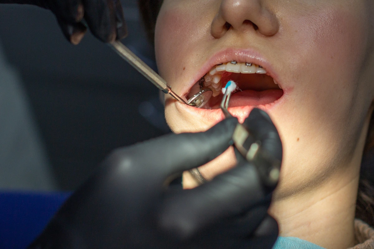 Emergencies 36 dental scaling in west ryde