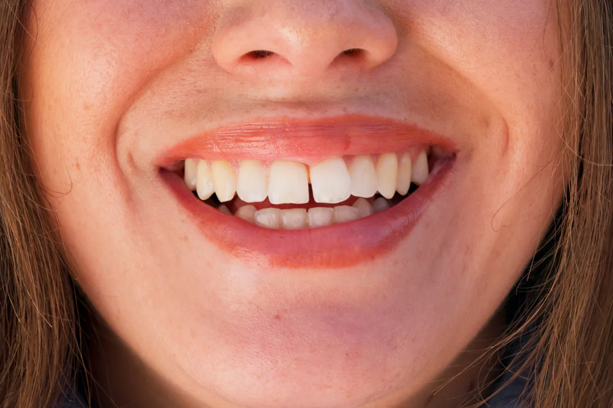 Gap Free Dental 14 Create Gap Free Dental