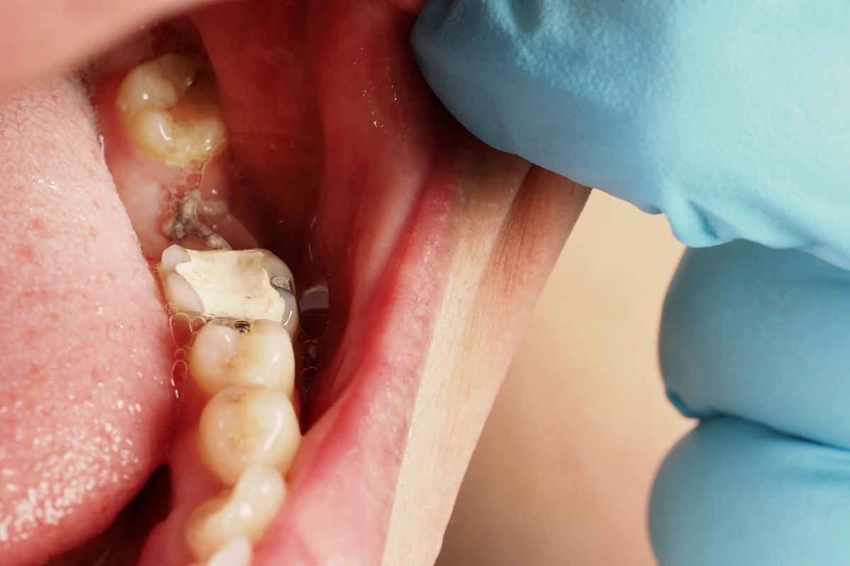 Gap Free Dental 13 Create Gap Free Dental