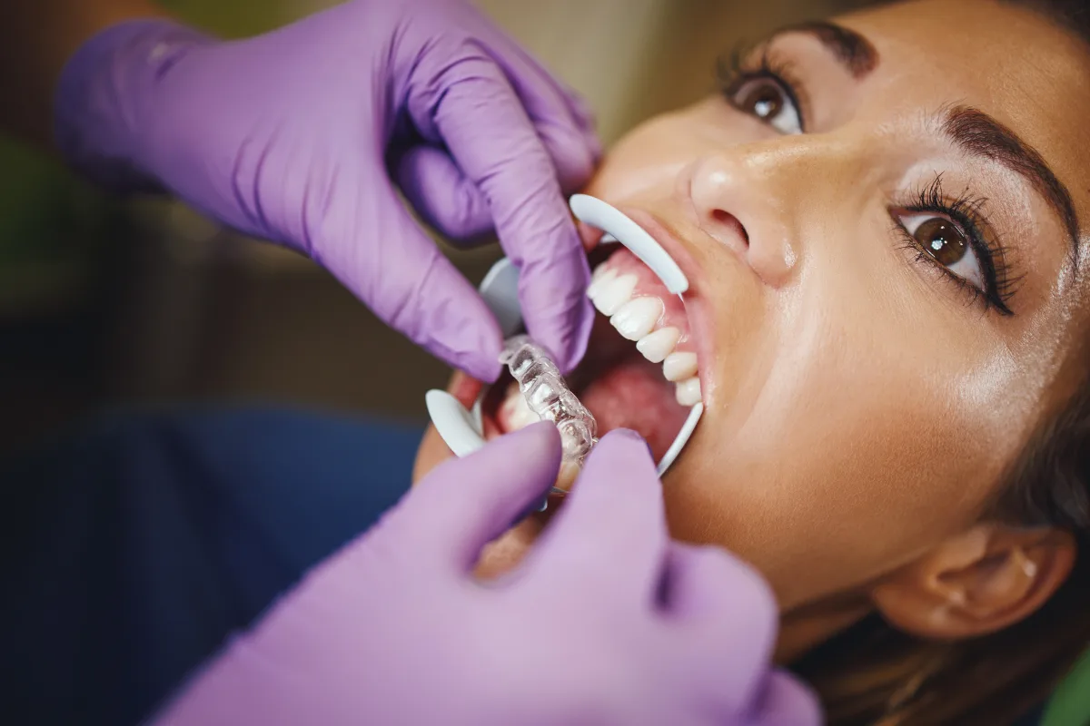 Orthodontics 13 Orthodontics