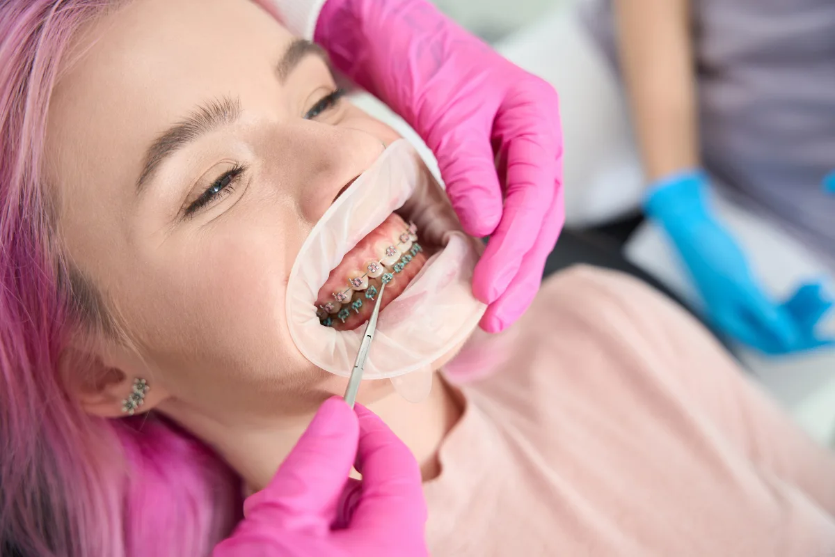 process-orthodontic-treatment Orthodontics