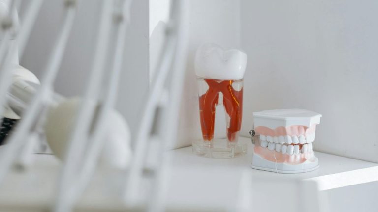 Root Canal Treatment