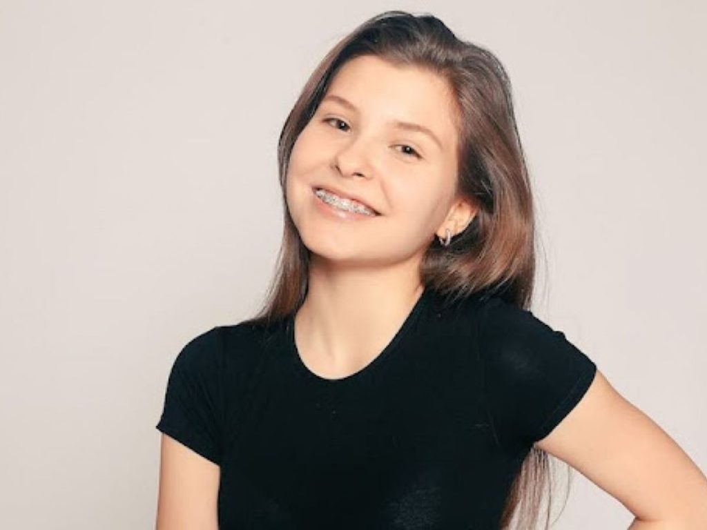 Ceramic Braces: A Complete Educational Guide 3 Ceramic Braces