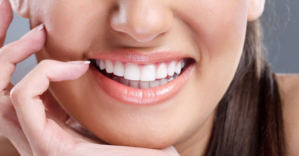 Education 19 Teeth Whitening