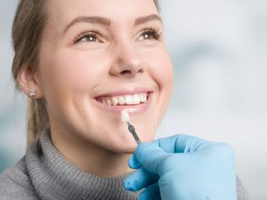 Dental Veneer